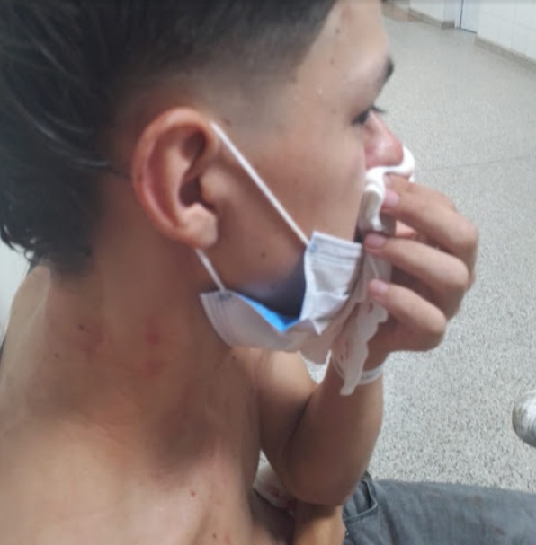 Resultó lesionado por la agresión de una patota al salir en defensa de un amigo 38