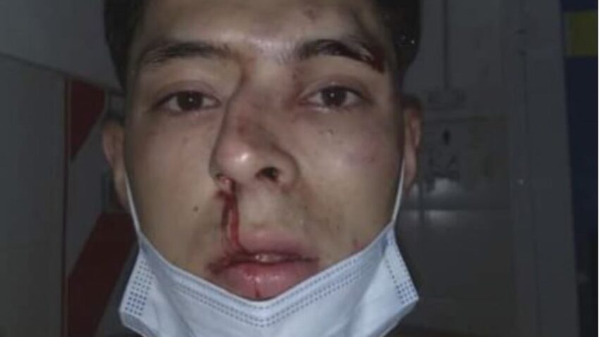 Un estudiante de periodismo deportivo recibió una brutal paliza en Sáenz Peña 38