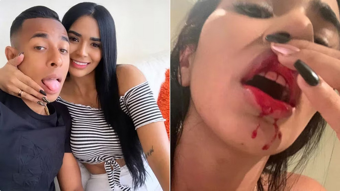 Piden dos años y tres meses de prisión para Sebastián Villa por violencia de género 37 La fotografía de Cortes lastimada, quje se expuso durante el juicio