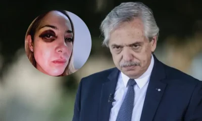 Alberto Fernández aseguró que Fabiola Yañez tenía el ojo morado por “un tratamiento estético contra las arrugas”