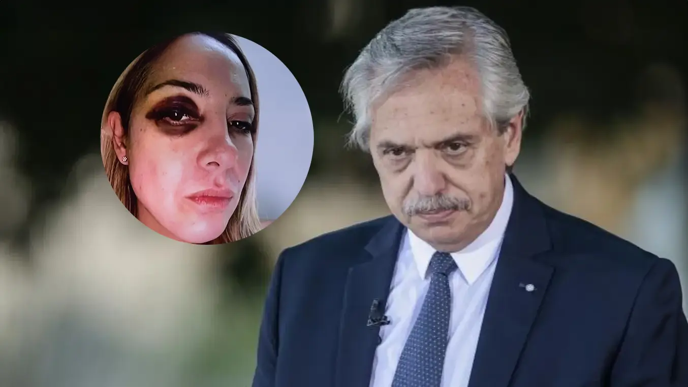 Alberto Fernández aseguró que Fabiola Yañez tenía el ojo morado por “un tratamiento estético contra las arrugas”