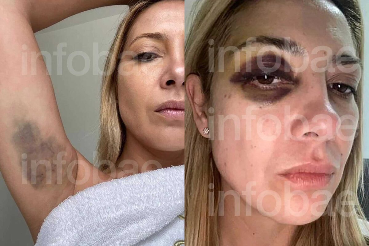 Difundieron fotos de Fabiola Yáñez: “Venís golpeándome hace tres días seguidos”