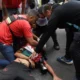 Continúa en estado crítico el fotógrafo que fue herido por la policía en la marcha al Congreso